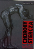 Choroby stercza prostaty i ich leczenie