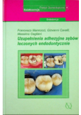Uzupełnienia adhezyjne zębów leczonych endodontycznie