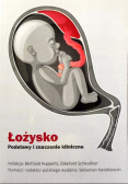 Łożysko Podstawy I Znaczenie Kliniczne