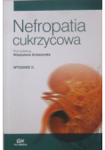 Nefropatia cukrzycowa