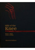Mri of the Knee