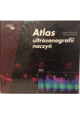 Atlas ultrasonografii naczyń
