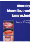 Choroby błony śluzowej jamy ustnej