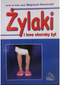 Żylaki i inne choroby żył