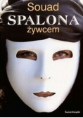 Spalona żywcem