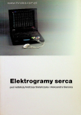 Elektrogramy serca