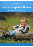 Dzieci z zespołem Downa