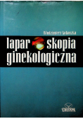 Laparoskopia ginekologiczna