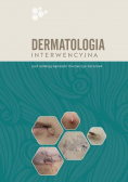 Dermatologia interwencyjna