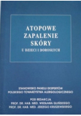 Atopowe zapalenie skóry