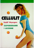 Cellulit zapobieganie i leczenie