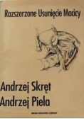 Rozszerzone usunięcie macicy