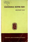 Zakażenia ropne ręki