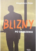 Blizny po ukąszeniu