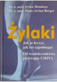 Żylaki