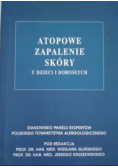 Atopowe zapalenie skóry