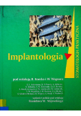 Implantologia
