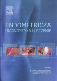 Endometrioza diagnostyka i leczenie