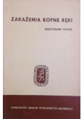 Zakażenia ropne ręki