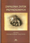 Zapalenia zatok przynosowych