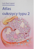 Atlas cukrzycy typu 2