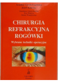 Chirurgia refrakcyjna rogówki