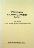Pokrzywka Atopowe zapalenie skóry
