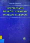 Uzupełnienie Braków Uzębienia Protezami Ruchomymi