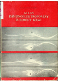 Atlas immunoelektroforezy surowicy krwi