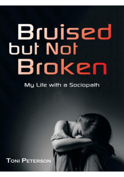 Bruised but Not Broken