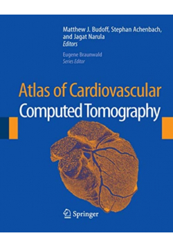 Atlas of Cardiovascular Computed Tomography