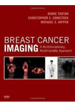 Breast Cancer Imaging A Multidisciplinary Multimodality Approach