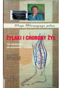 Żylaki i choroby żył