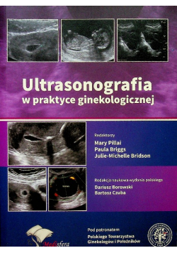 Ultrasonografia w praktyce ginekologicznej