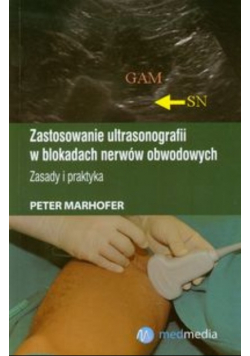 Zastosowanie ultrasonografii w blokadach nerwów obwodowych