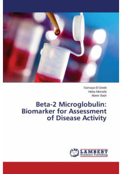 Beta-2 Microglobulin