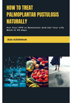 How To Treat Palmoplantar Pustulosis Naturally