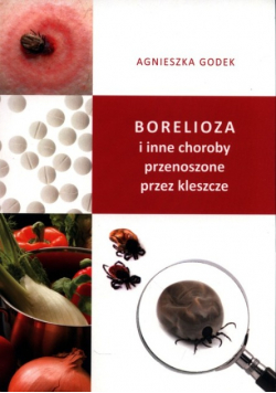 Borelioza i inne choroby przenoszone przez kleszcze