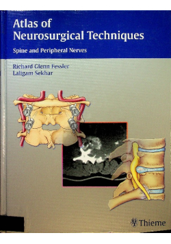 Spine Surgery Tricks of the Trade