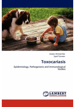 Toxocariasis