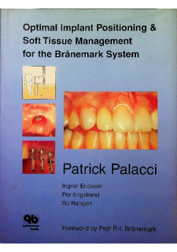 Optimal Implant Positioning and Soft Tissue Management for the Branemark System