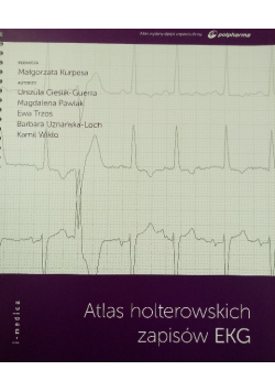 Atlas holterowskich zapisów EKG