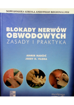 Blokady nerwów obwodowych
