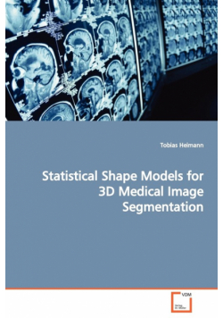 Statistical Shape Models for 3D Medical Image Segmentation