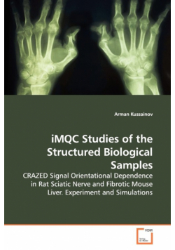 iMQC Studies of the Structured Biological Samples