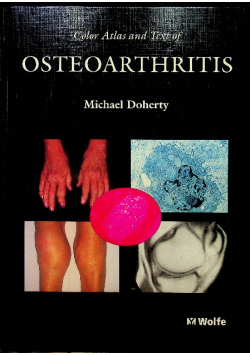 Color Atlas and Text of Osteoarthritis
