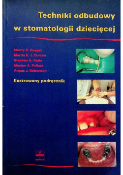 Techniki odbudowy w stomatologii dziecięcej