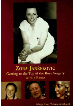 Getting to the top of the Burn Suegery with a Razor