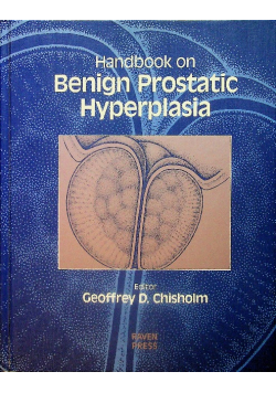 Handbook on Benign Prostatic Hyperplasia
