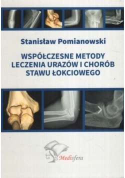 Współczesne metody leczenia urazów i chorób stawu łokciowego
